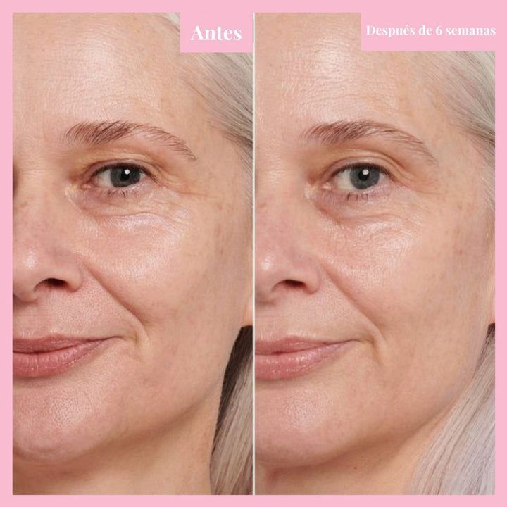 GlowLift™ - masajeador facial