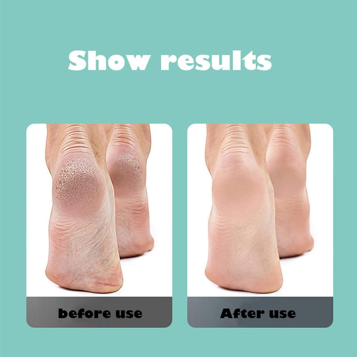 REMOVEDOR DE CALLOS ELÉCTRICO PARA PIES: FeetGlow™