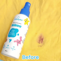 ManchaGone™ - Quitamanchas de tela todo en uno