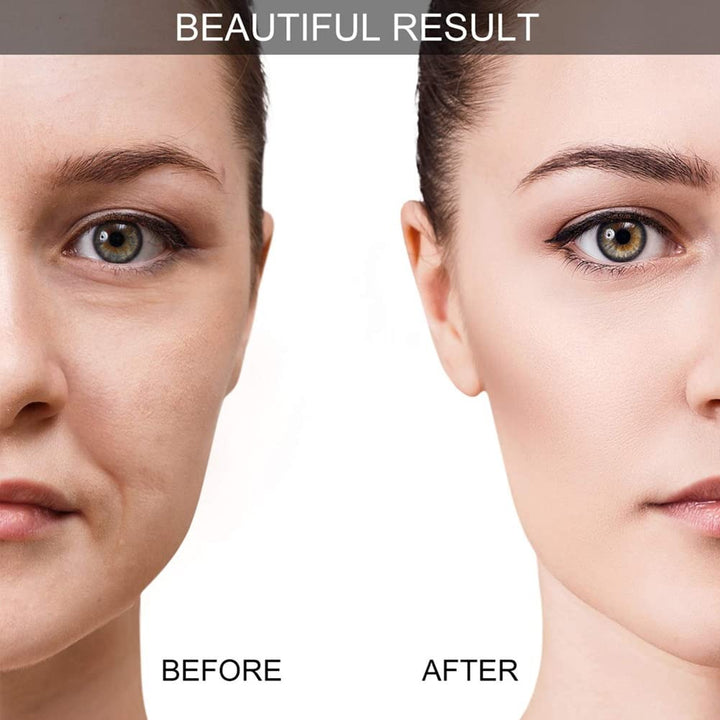 Harvey™ - Mejoramiento instantáneo de piel